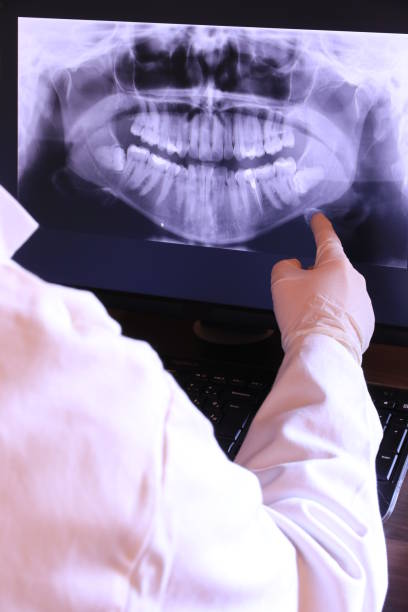 Best Emergency Dental Care for Broken or Chipped Teeth in Pinch, WV